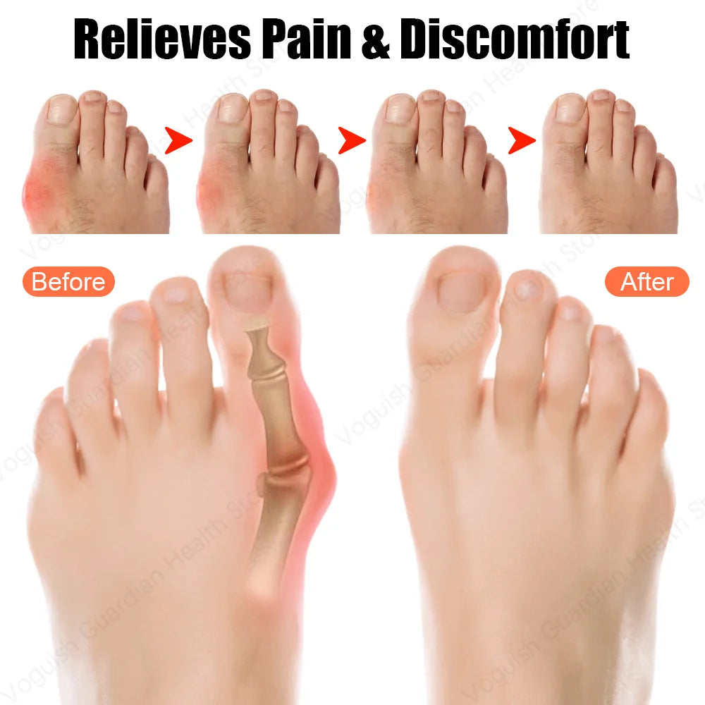 PureFeet™ Bunion Corrector Tape