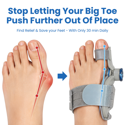 PureFeet™ BunionPro
